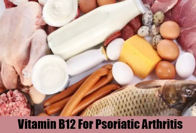 5 Natural Tips On How To Cure Psoriatic Arthritis