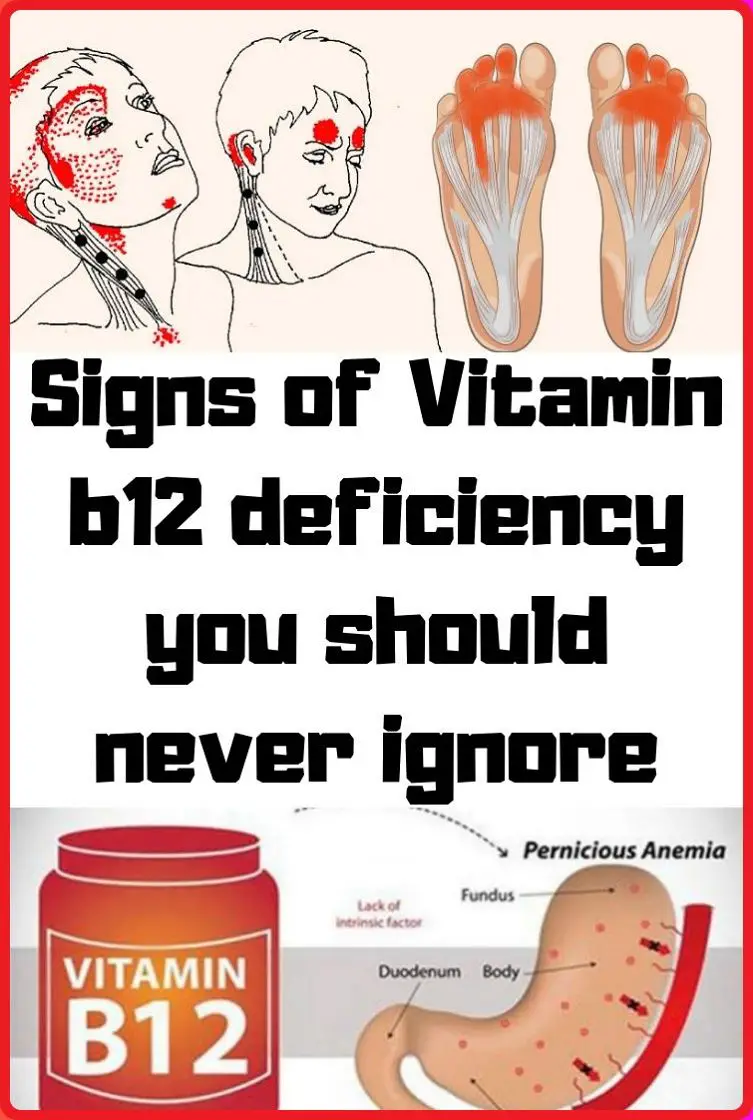 5 Warning Signs of Vitamin B12 Deficiency You Should Never ...