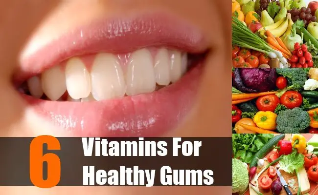 6 Best Vitamins For Healthy Gums
