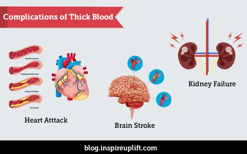 6 Healthy and Natural Blood Thinners (No More Aspirin)