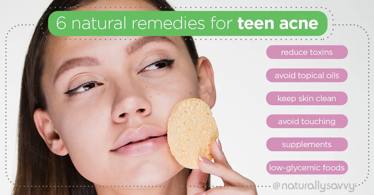 7 Effective Natural Remedies for Teen Acne