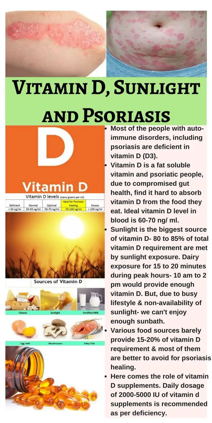 9 Ways to Help Your Psoriasis