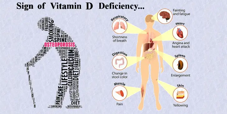 Can Low Levels of Vitamin D Cause Serious Health Concerns ...