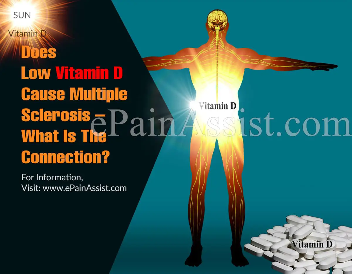 Does Low Vitamin D Cause Multiple Sclerosis â What Is The ...
