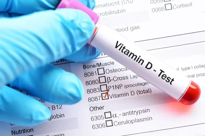Global Vitamin D Testing Market Size, Analysis, Share,