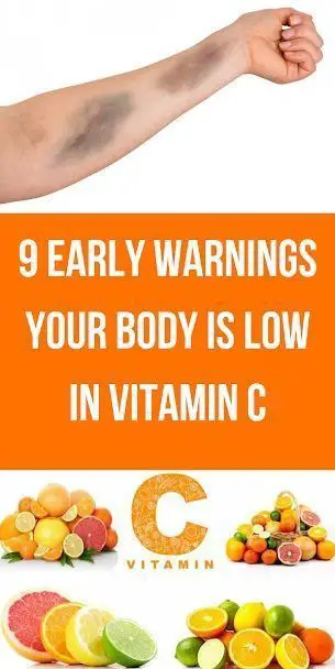 How Much Vitamin C Should I Take If Sick