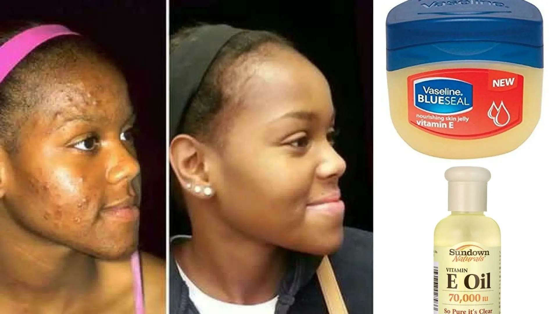 How Vaseline With Vitamin E Oil Can Change Your Skin ...