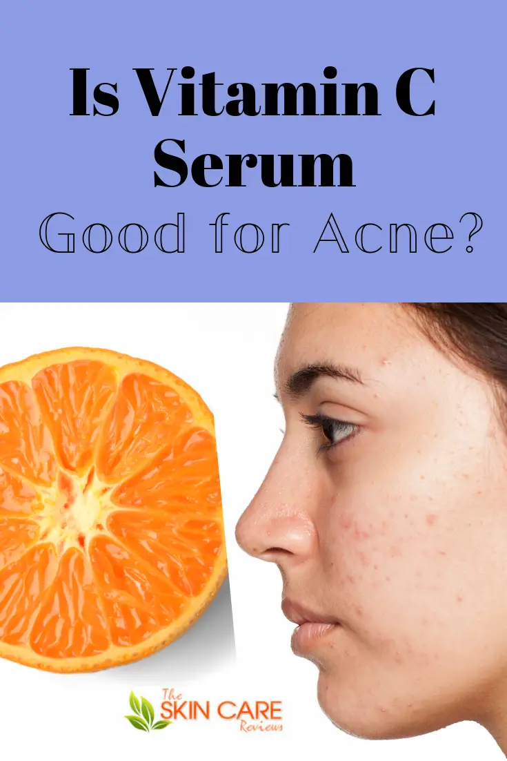 Is vitamin C serum good for acne and how does it help acne ...