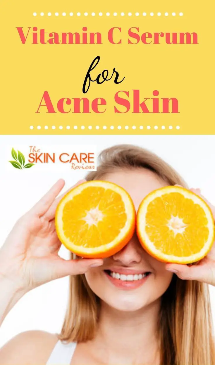 Is Vitamin C Serum Good For Acne Prone Skin?