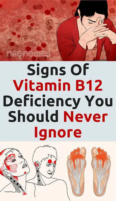 Signs Of Vitamin B12 Deficiency You Should Never Ignore ...
