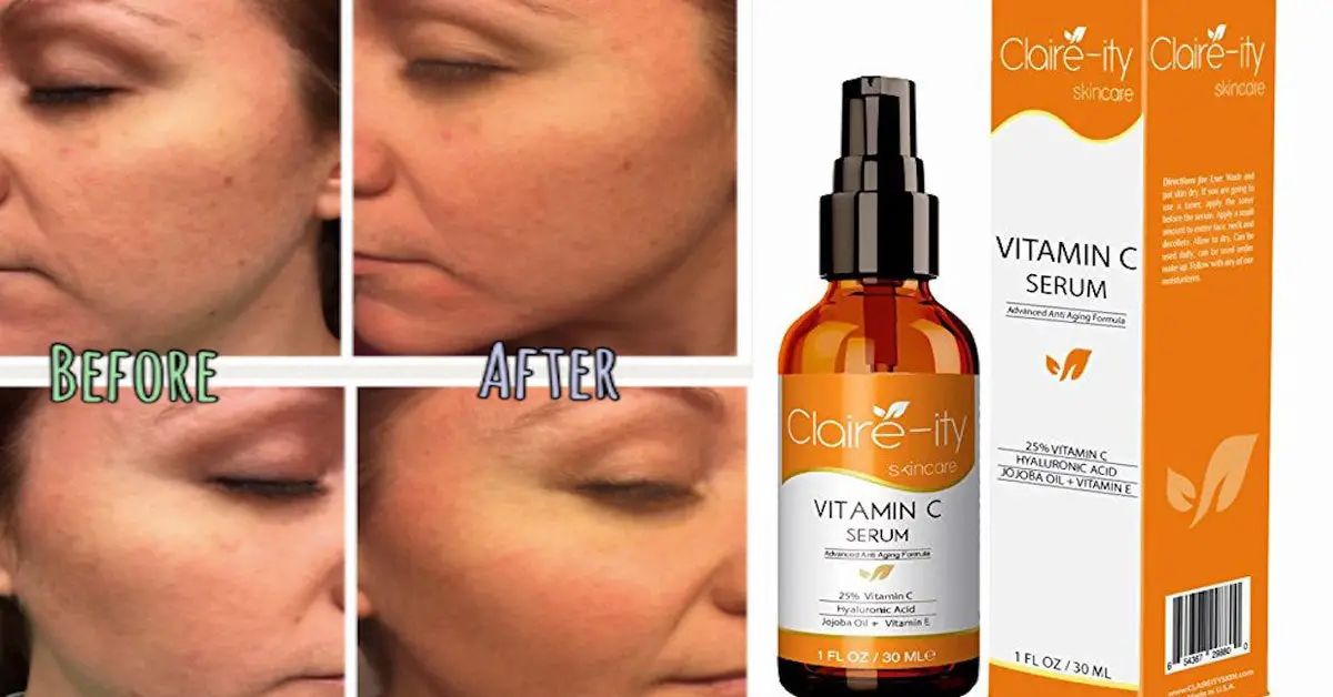This Vitamin C Serum Might Be The Best Thing To Ever Happen To Your Skin