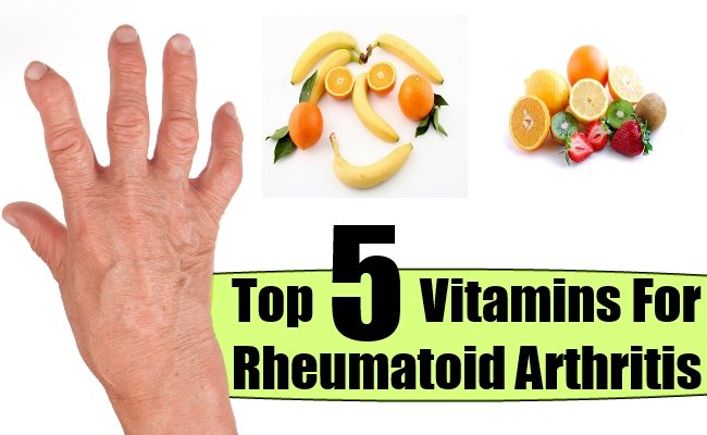 Top 5 Vitamins For Rheumatoid Arthritis  Natural Home Remedies ...