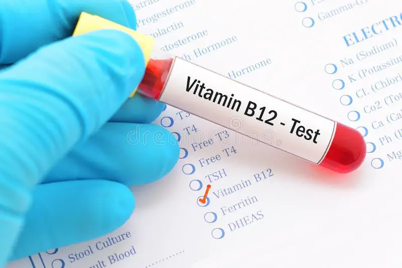 Vitamin B12 test stock image. Image of research, analyzing ...