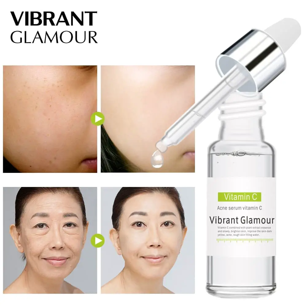 Vitamin C Acne Treatment Fade Dark Spots Anti Aging Skin Care Whitening ...