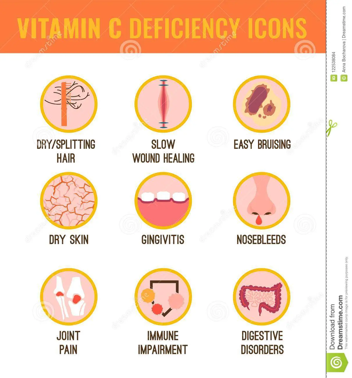 Vitamin C deficiency stock vector. Illustration of data