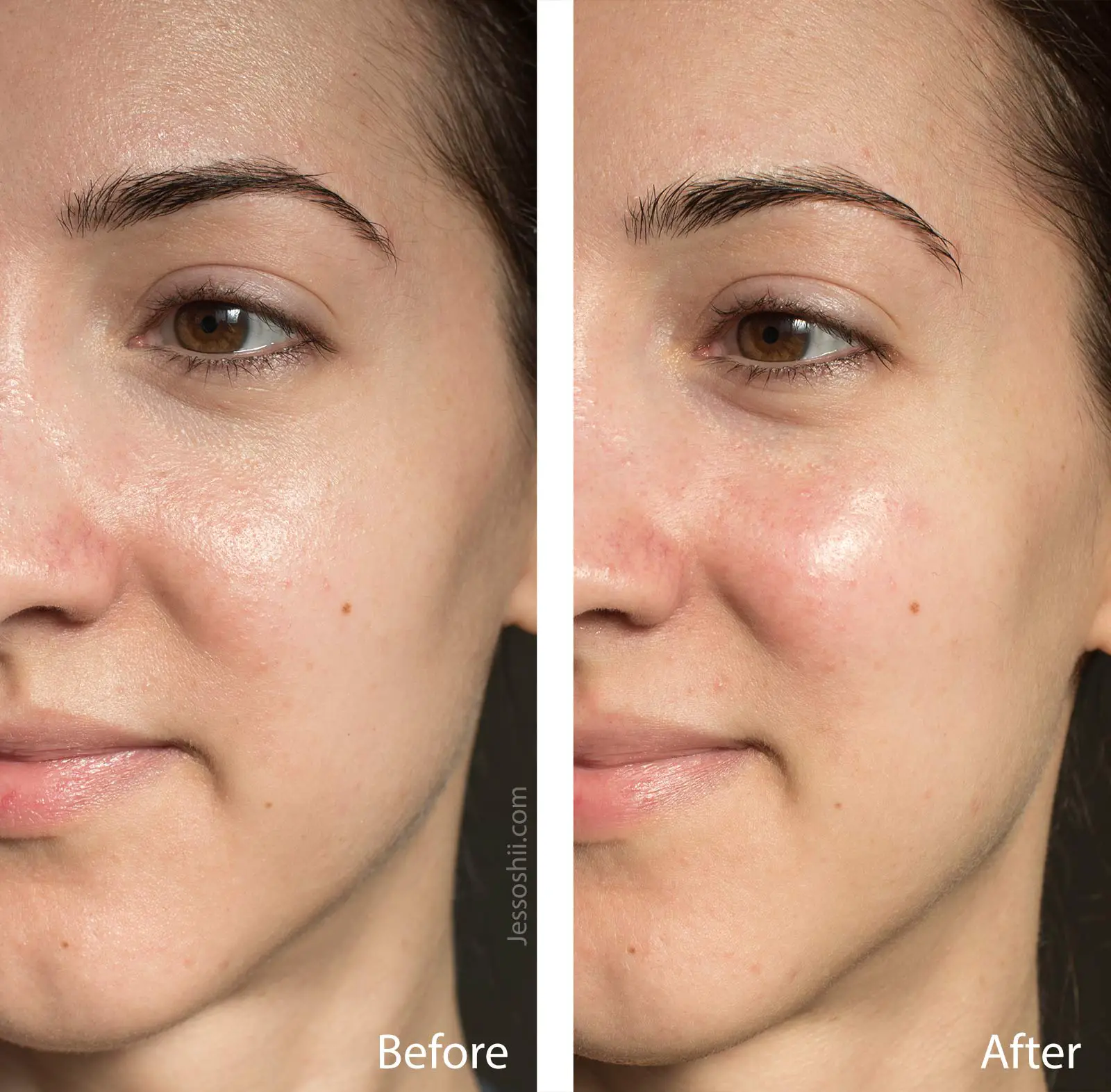 Vitamin C Mask Before And After