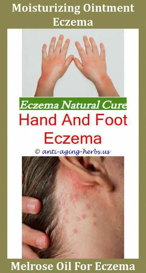 Vitamin D Eczema Cure