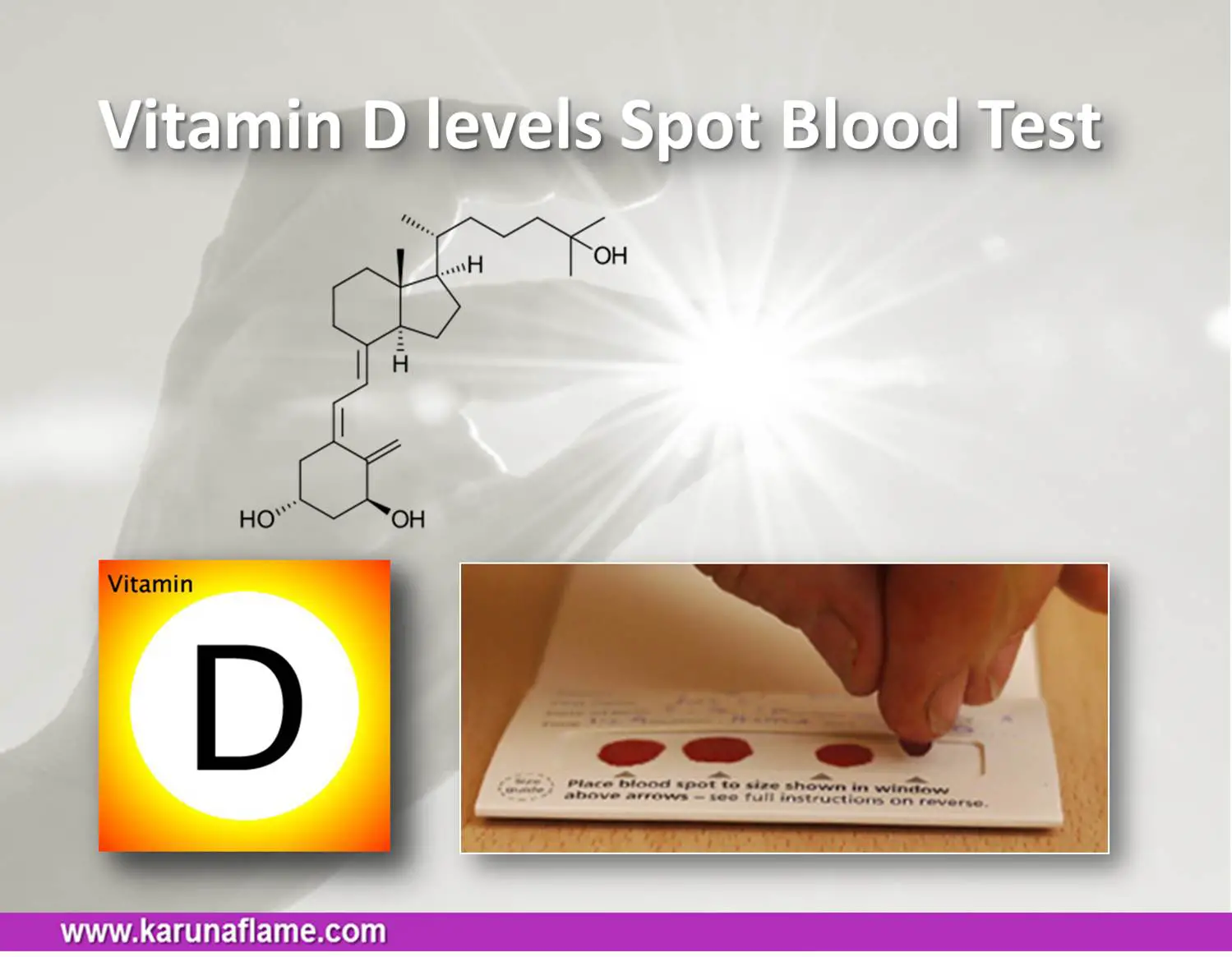 Vitamin D Levels Test