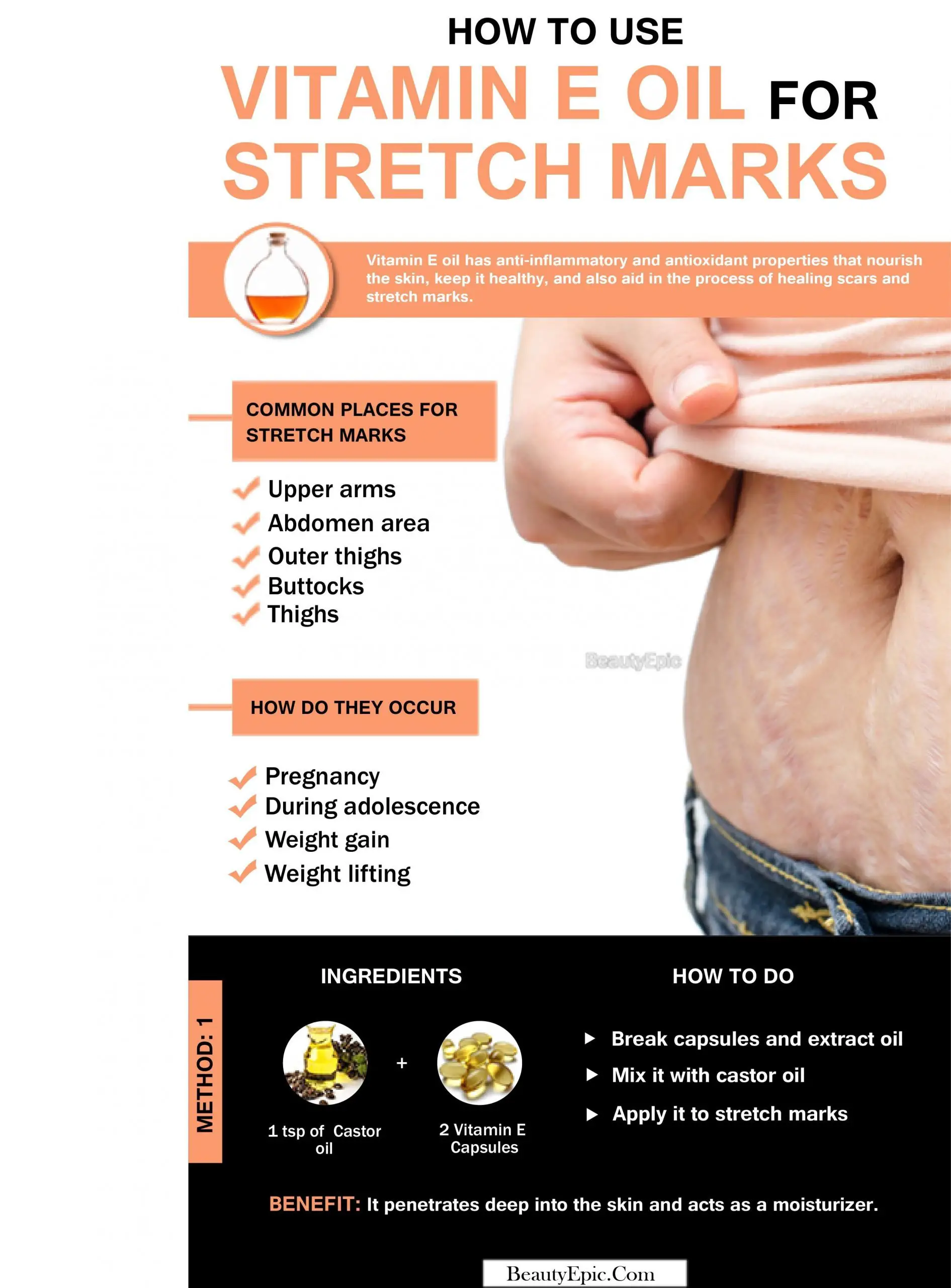 Vitamin E oil for Stretch Marks #StretchMarksRemoval